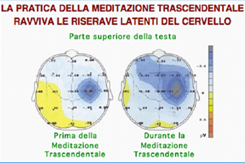 Stati di Coscienza